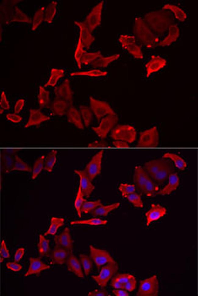 SKAP2 Antibody in Immunocytochemistry (ICC/IF)