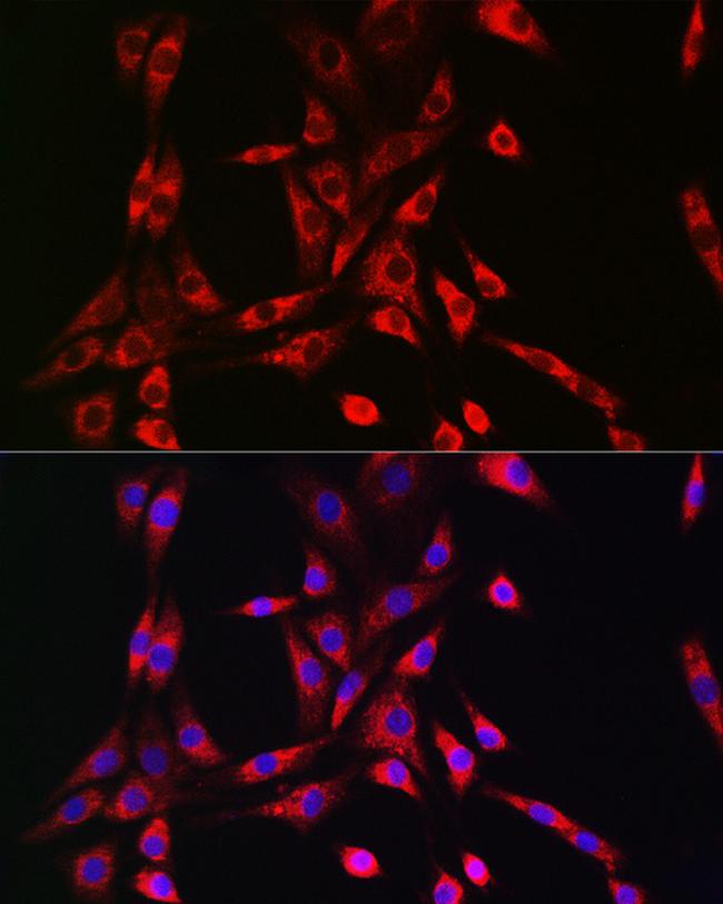 PIK3R4 Antibody in Immunocytochemistry (ICC/IF)