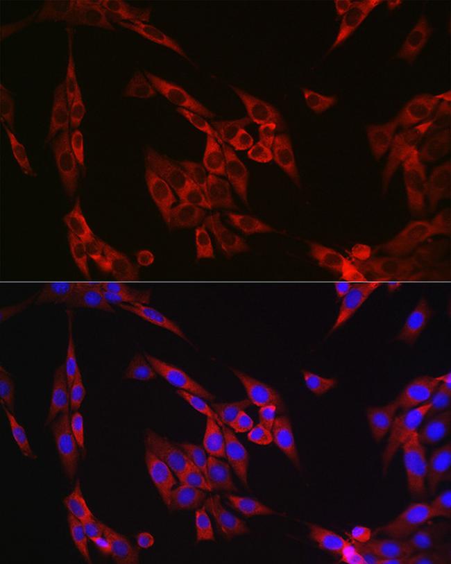 Cyclin B1 Antibody in Immunocytochemistry (ICC/IF)