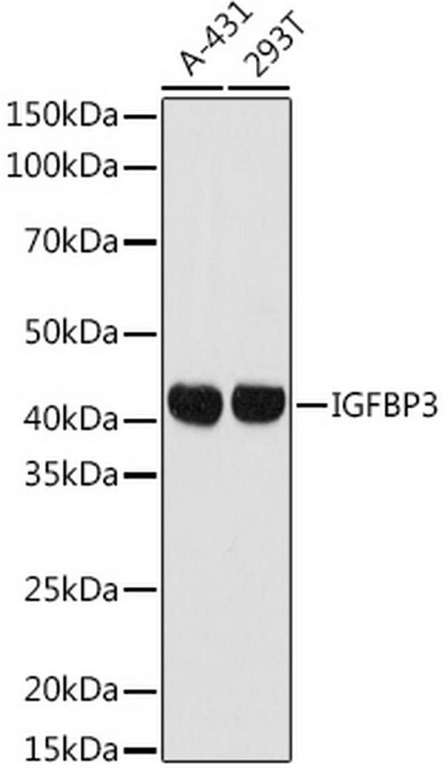 IGFBP3 Antibody in Western Blot (WB)