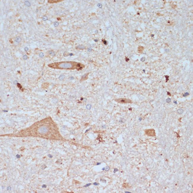 VAChT Antibody in Immunohistochemistry (Paraffin) (IHC (P))