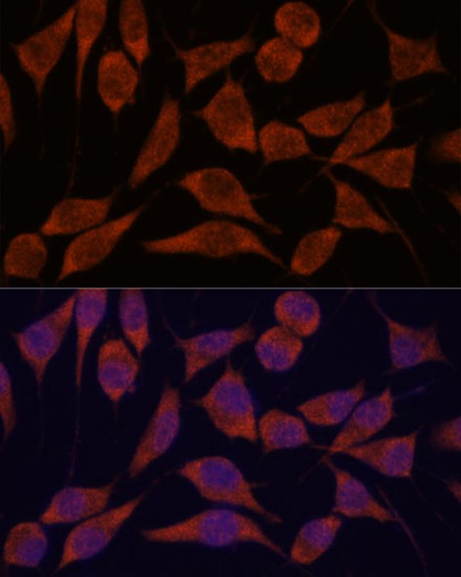 TRAPPC6A Antibody in Immunocytochemistry (ICC/IF)