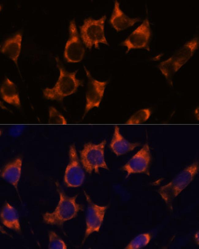 NDRG4 Antibody in Immunocytochemistry (ICC/IF)