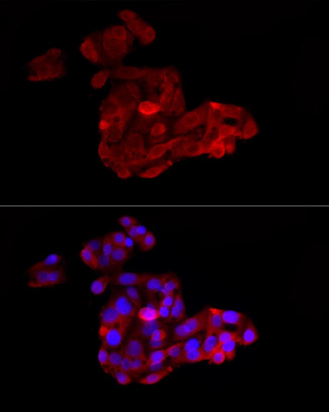 ACSL1 Antibody in Immunocytochemistry (ICC/IF)