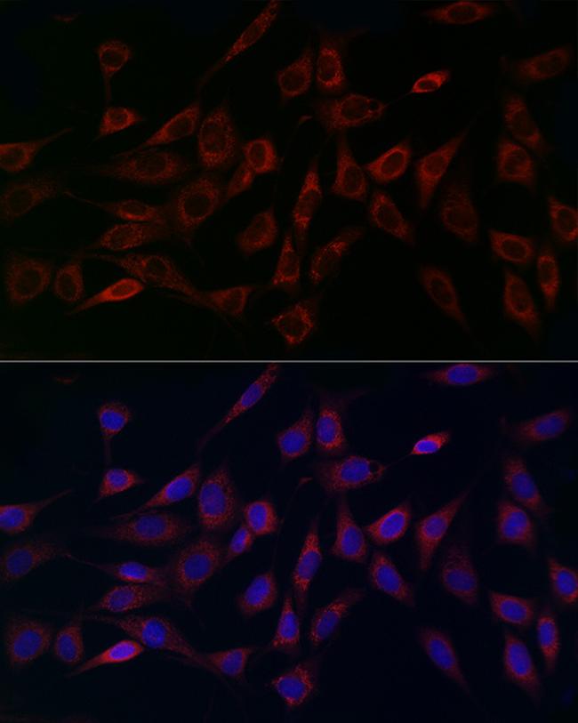 MCU Antibody in Immunocytochemistry (ICC/IF)