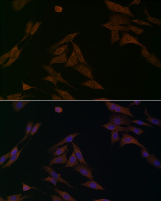 BCAT1 Antibody in Immunocytochemistry (ICC/IF)