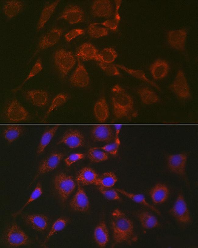 BOK Antibody in Immunocytochemistry (ICC/IF)