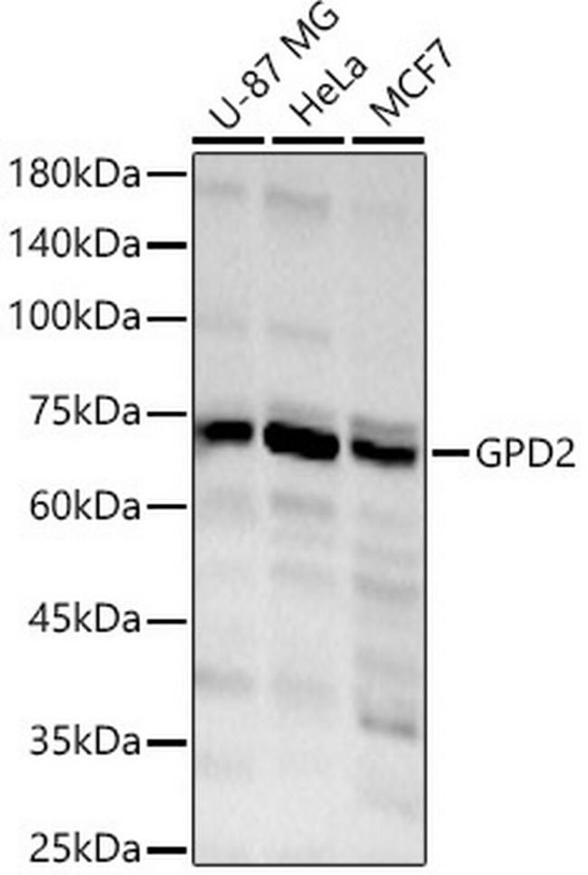 GPD2 Antibody in Western Blot (WB)