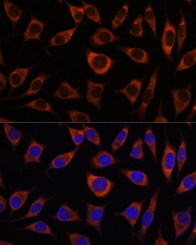 CTNNA3 Antibody in Immunocytochemistry (ICC/IF)