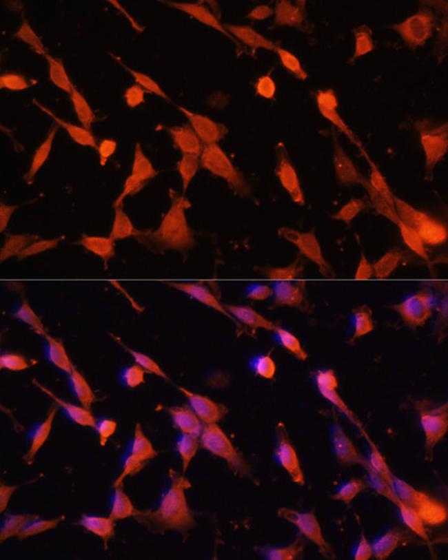 Caspase 3 Antibody in Immunocytochemistry (ICC/IF)