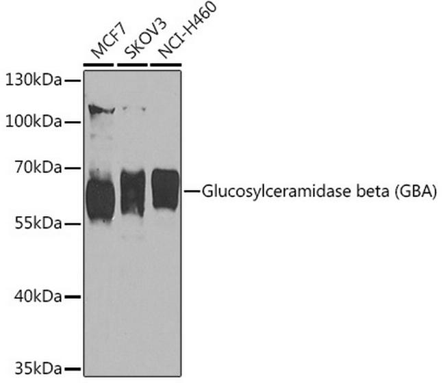 GBA Antibody in Western Blot (WB)