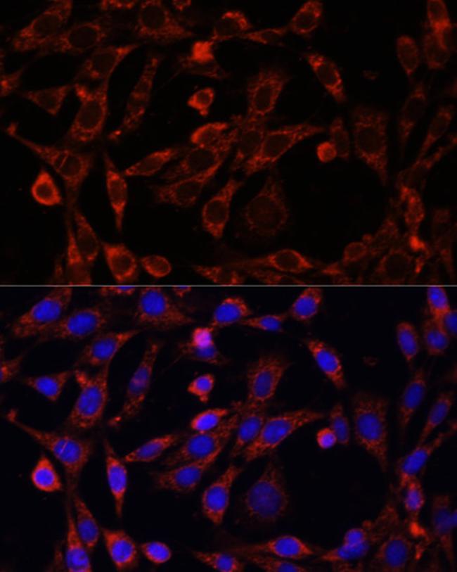 UCP3 Antibody in Immunocytochemistry (ICC/IF)