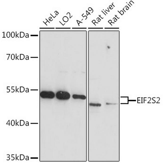 eIF2 beta Antibody in Western Blot (WB)