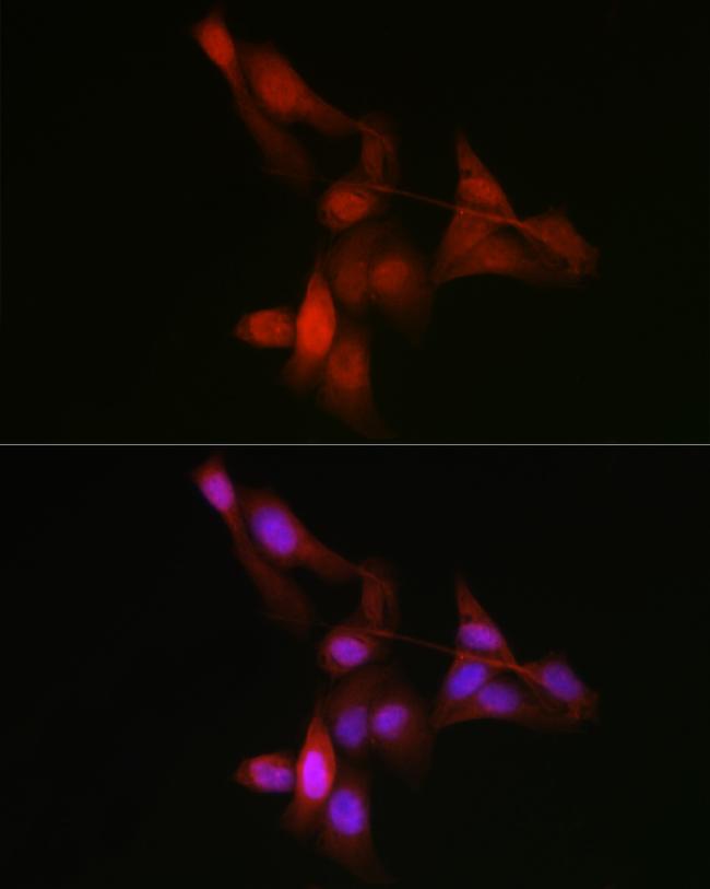 YAP1 Antibody in Immunocytochemistry (ICC/IF)