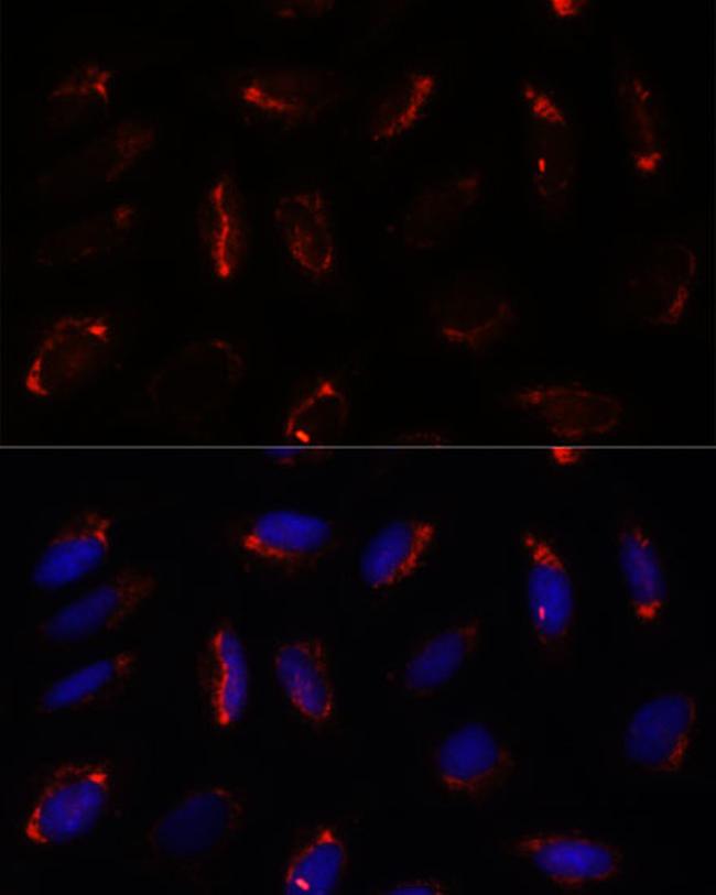 MRPS7 Antibody in Immunocytochemistry (ICC/IF)