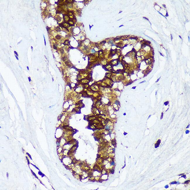 HSD17B7 Antibody in Immunohistochemistry (Paraffin) (IHC (P))