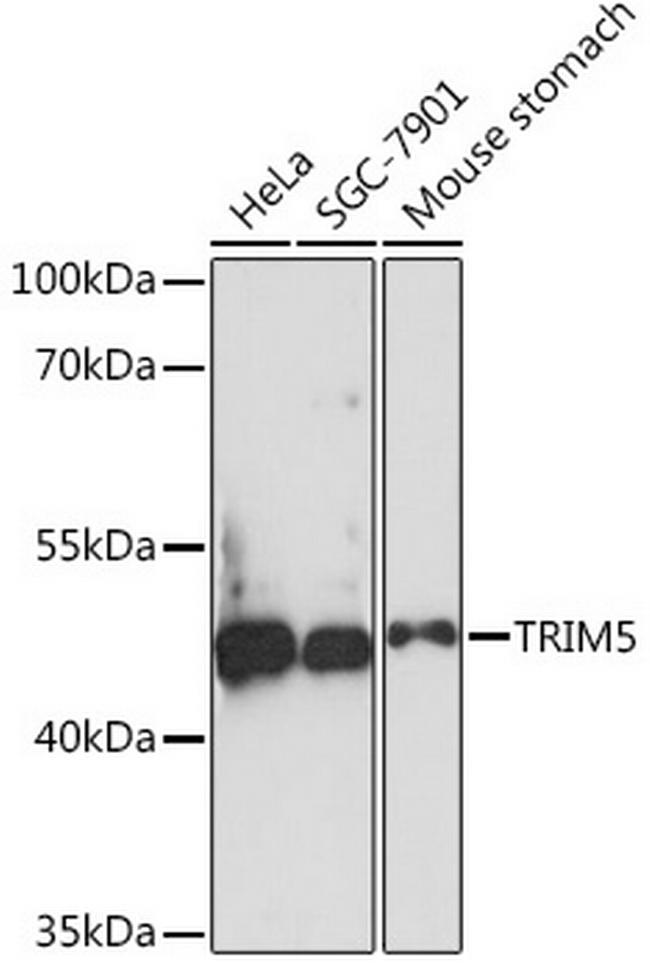 TRIM5 beta Antibody in Western Blot (WB)