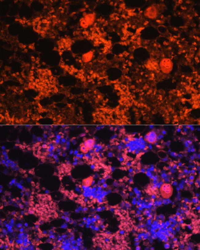 PF4 Antibody in Immunocytochemistry (ICC/IF)