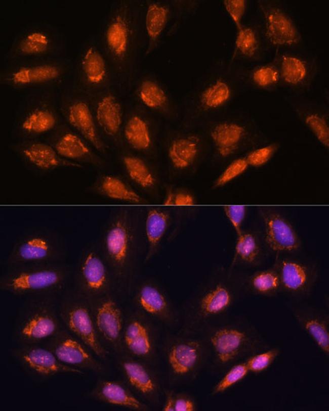 TIMM44 Antibody in Immunocytochemistry (ICC/IF)