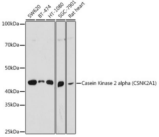 CK2 alpha-1 Antibody in Western Blot (WB)