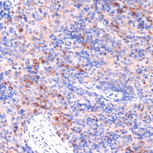 PIK3R2 Antibody in Immunohistochemistry (Paraffin) (IHC (P))