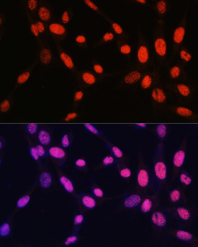 H2BK5me1 Antibody in Immunocytochemistry (ICC/IF)