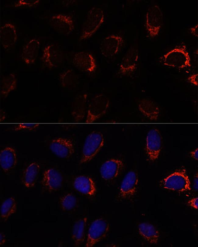 AP3S2 Antibody in Immunocytochemistry (ICC/IF)