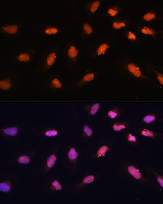 BAZ2A Antibody in Immunocytochemistry (ICC/IF)