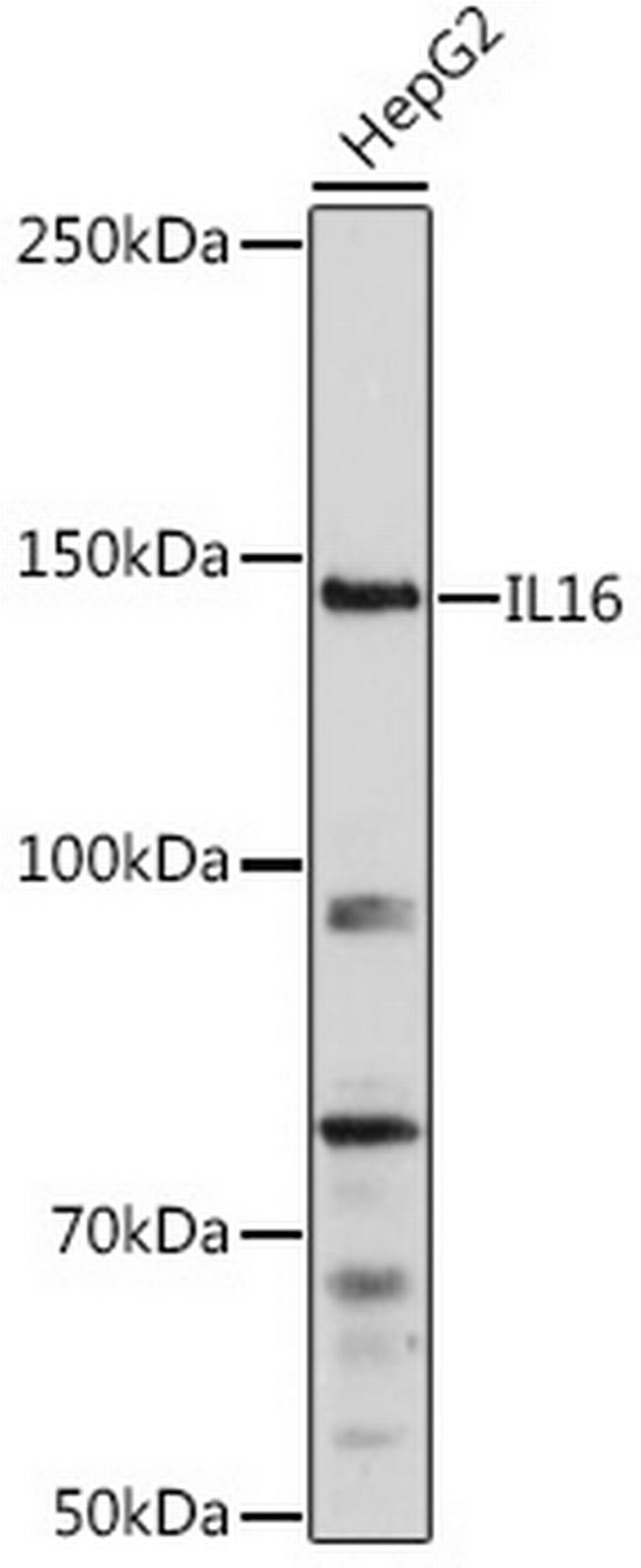 IL-16 Antibody in Western Blot (WB)