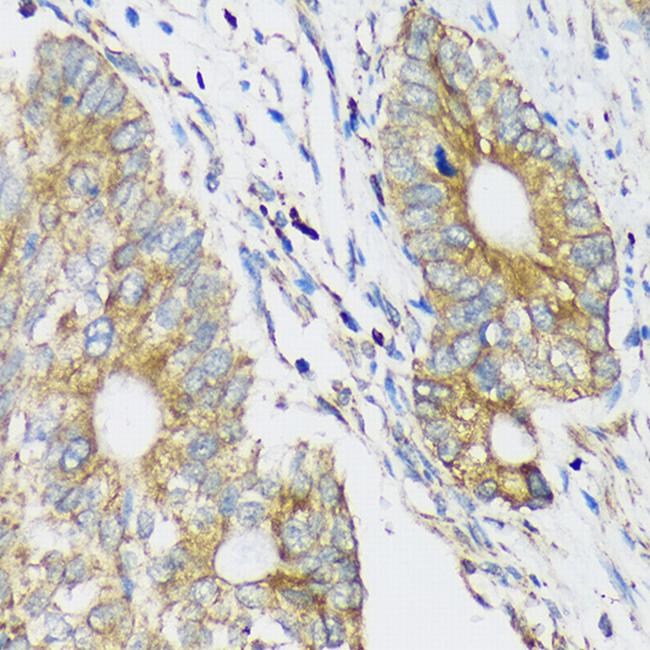 CLCC1 Antibody in Immunohistochemistry (Paraffin) (IHC (P))