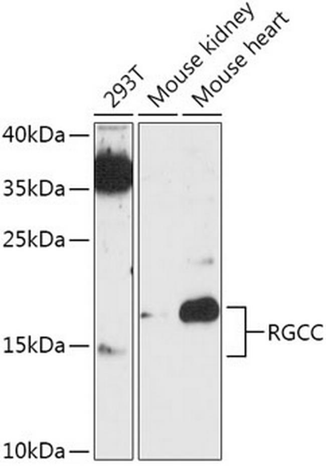 C13orf15 Antibody in Western Blot (WB)