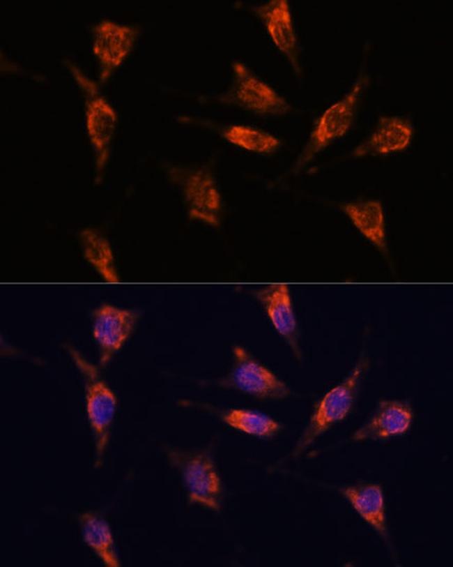 GNPNAT1 Antibody in Immunocytochemistry (ICC/IF)