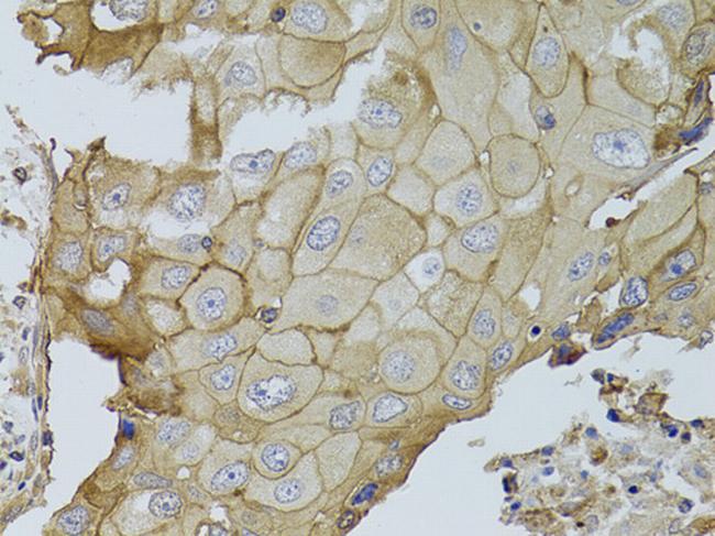 GGT1 Antibody in Immunohistochemistry (Paraffin) (IHC (P))