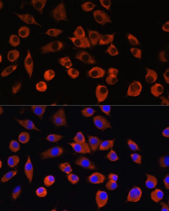 PIGM Antibody in Immunocytochemistry (ICC/IF)