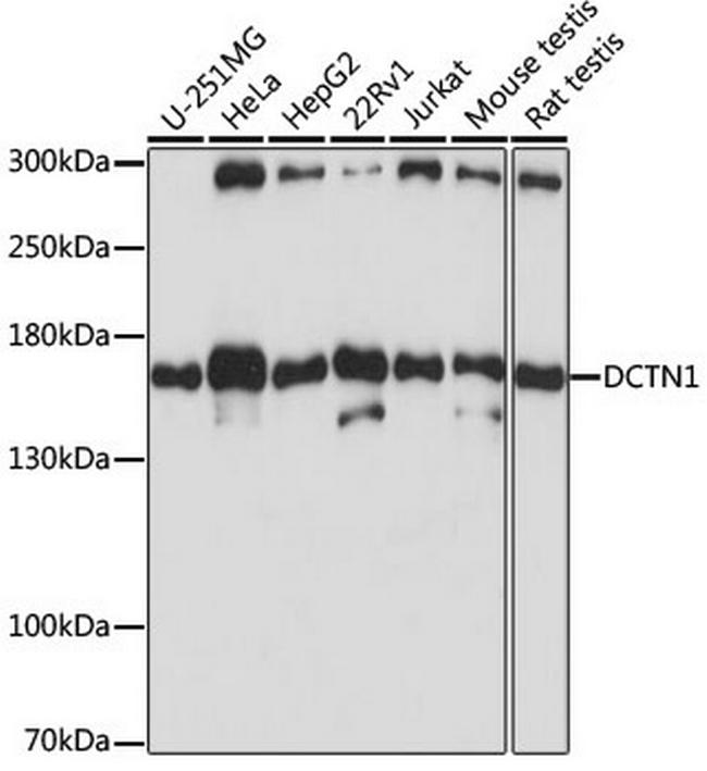 Dynactin 1 Antibody in Western Blot (WB)