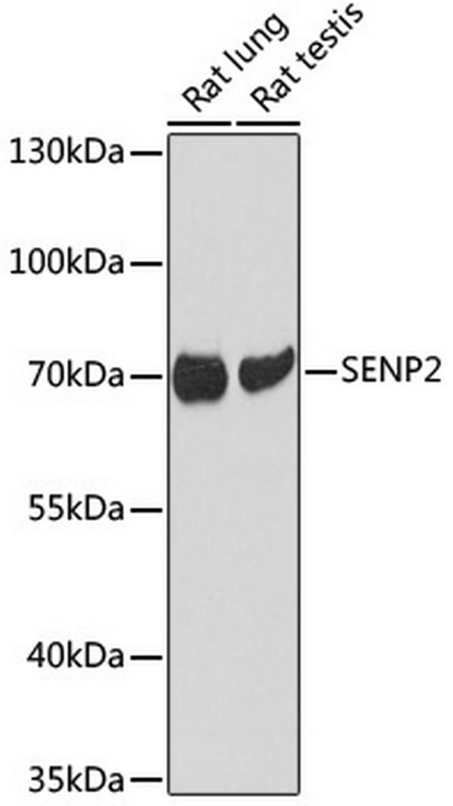 SENP2 Antibody in Western Blot (WB)