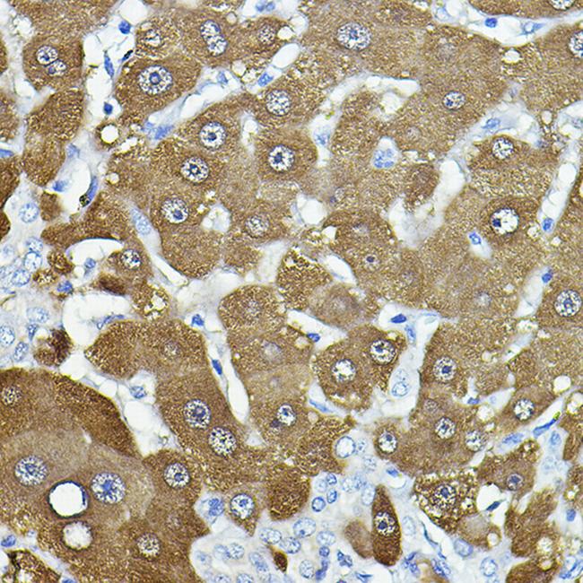 NNMT Antibody in Immunohistochemistry (Paraffin) (IHC (P))