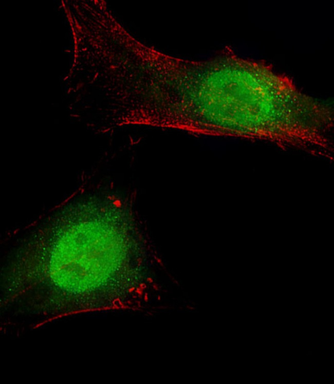 BAP1 Antibody in Immunocytochemistry (ICC/IF)