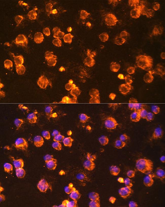 Fyn Antibody in Immunocytochemistry (ICC/IF)