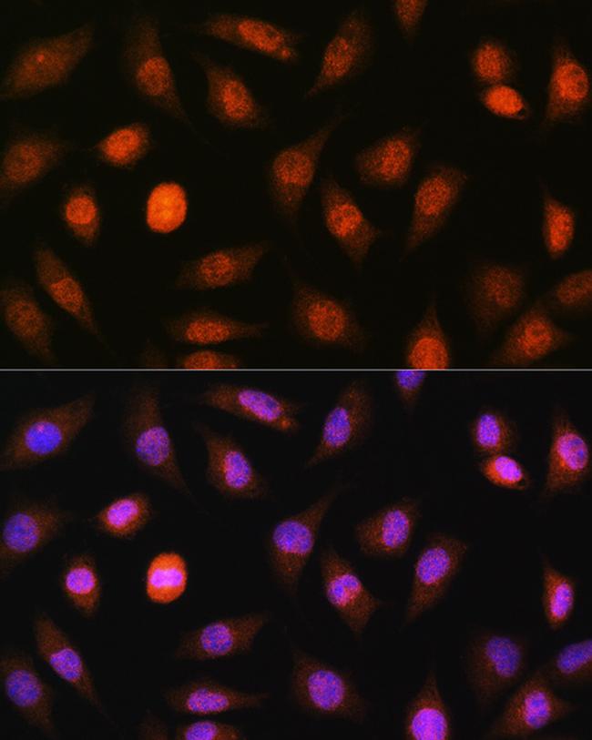 PML-5 Antibody in Immunocytochemistry (ICC/IF)