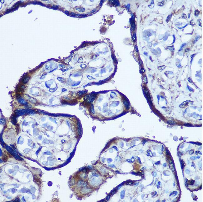 TBCCD1 Antibody in Immunohistochemistry (Paraffin) (IHC (P))