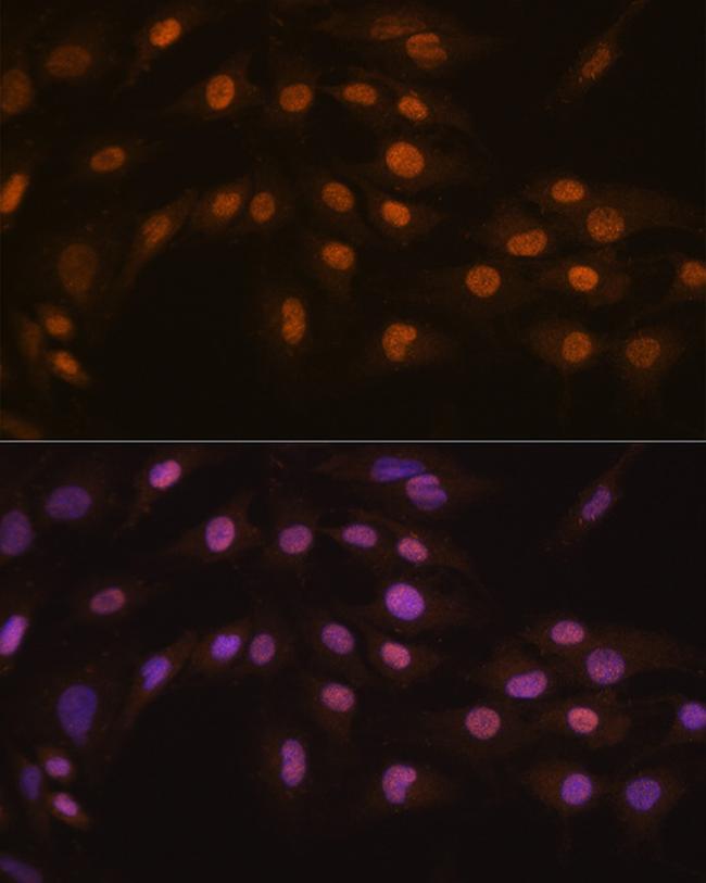 ZFPM1 Antibody in Immunocytochemistry (ICC/IF)