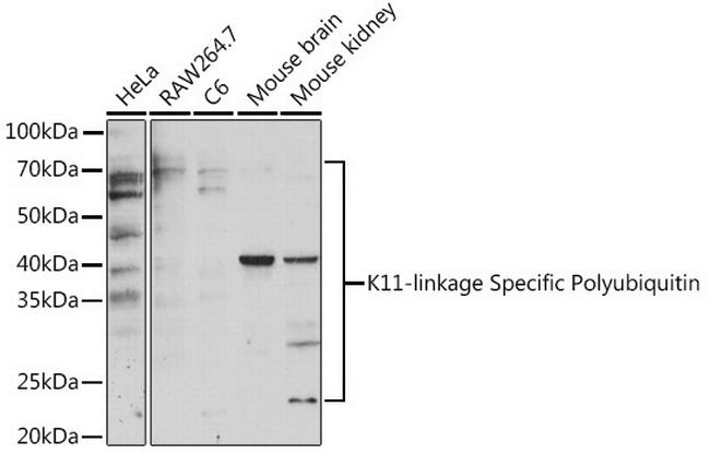 Ub-K11 Antibody in Western Blot (WB)