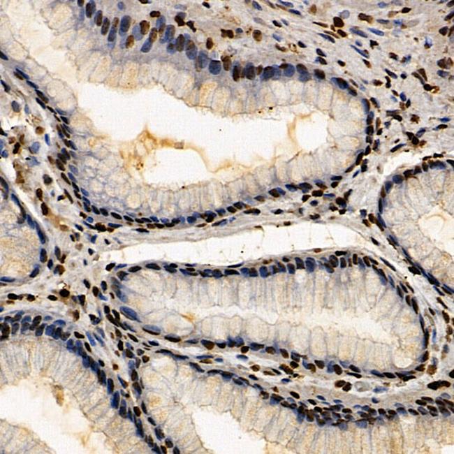 CSB Antibody in Immunohistochemistry (Paraffin) (IHC (P))