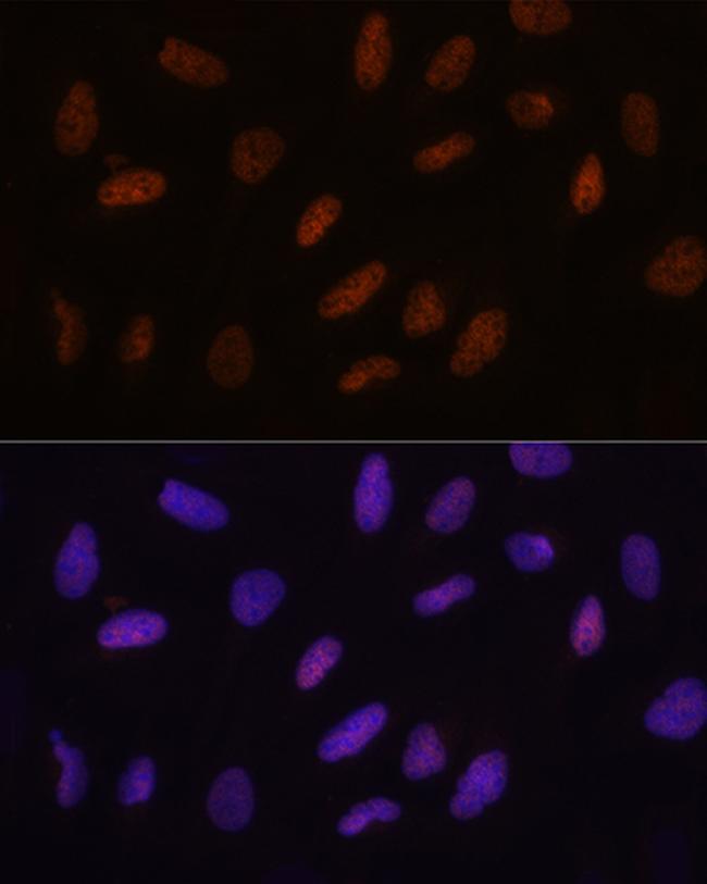 TET3 Antibody in Immunocytochemistry (ICC/IF)