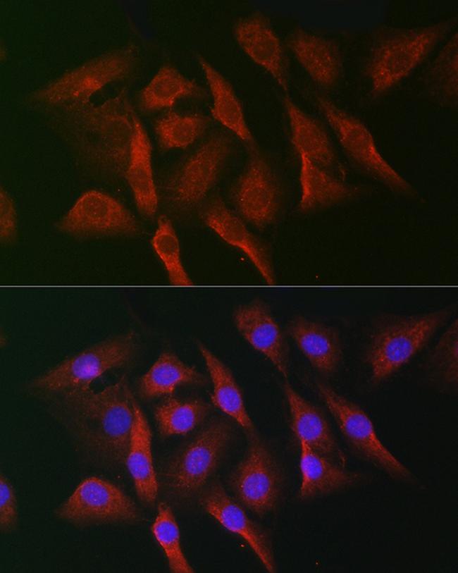 MNK1 Antibody in Immunocytochemistry (ICC/IF)