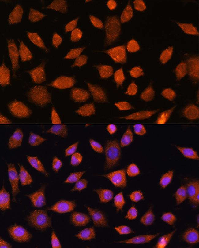 PLD3 Antibody in Immunocytochemistry (ICC/IF)