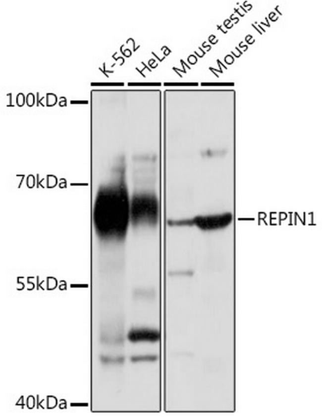 REPIN1 Antibody in Western Blot (WB)