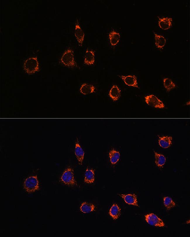 DJ-1 Antibody in Immunocytochemistry (ICC/IF)