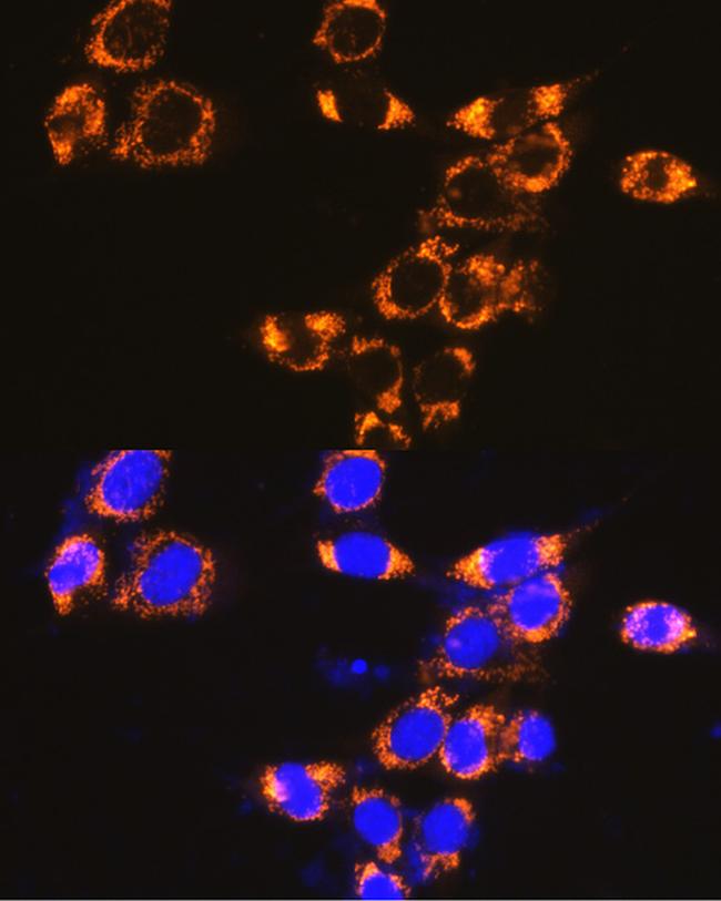 IFNAR1 Antibody in Immunocytochemistry (ICC/IF)